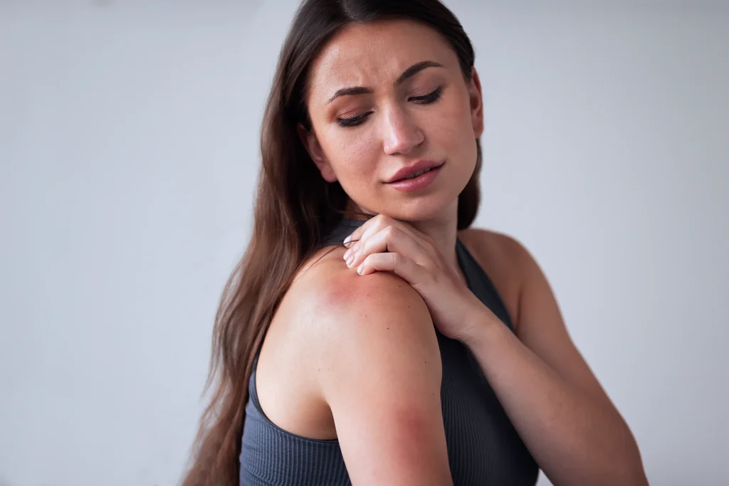 Eczema care at AgeRejuvenation