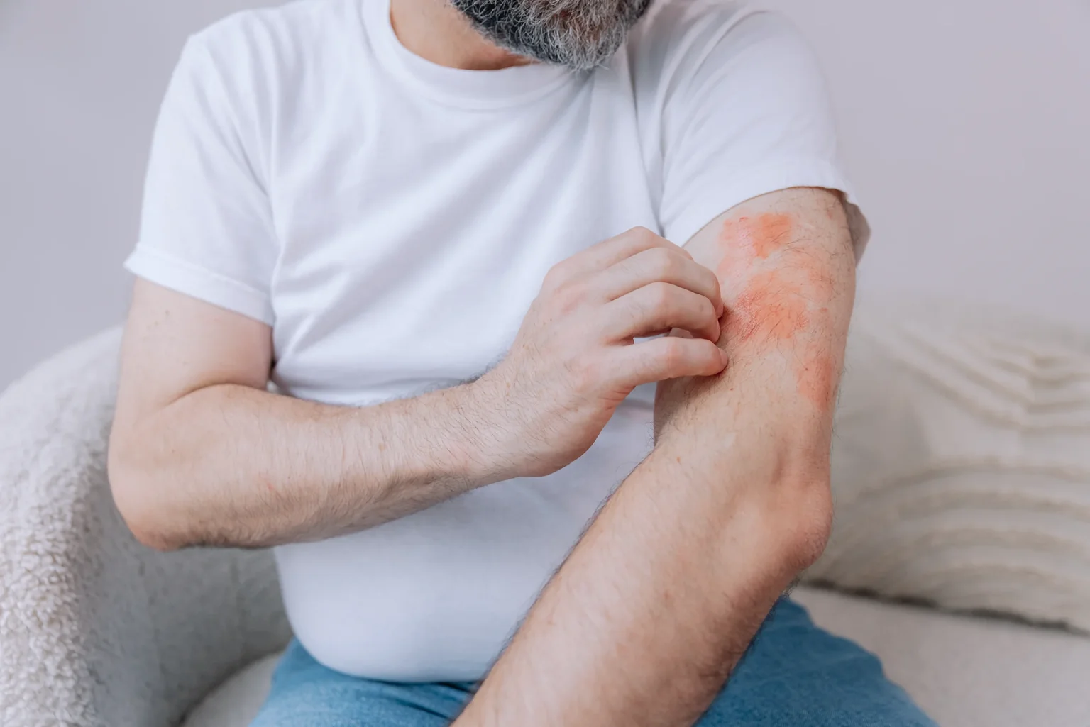 Eczema care at AgeRejuvenation
