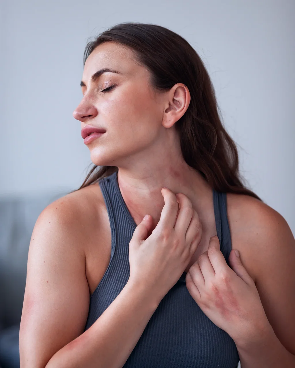 Psoriasis at AgeRejuvenation