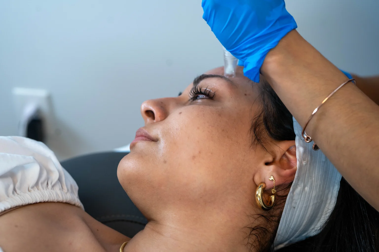 SkinPen microneedling collagen induction treatment at AgeRejuvenation in Brandon, FL