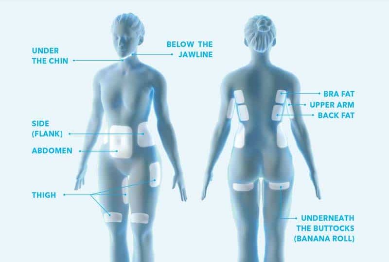 coolsculpting