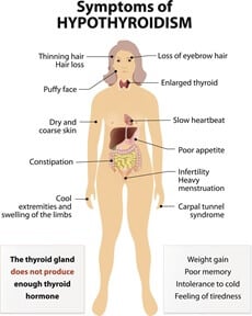 hypothyroidism