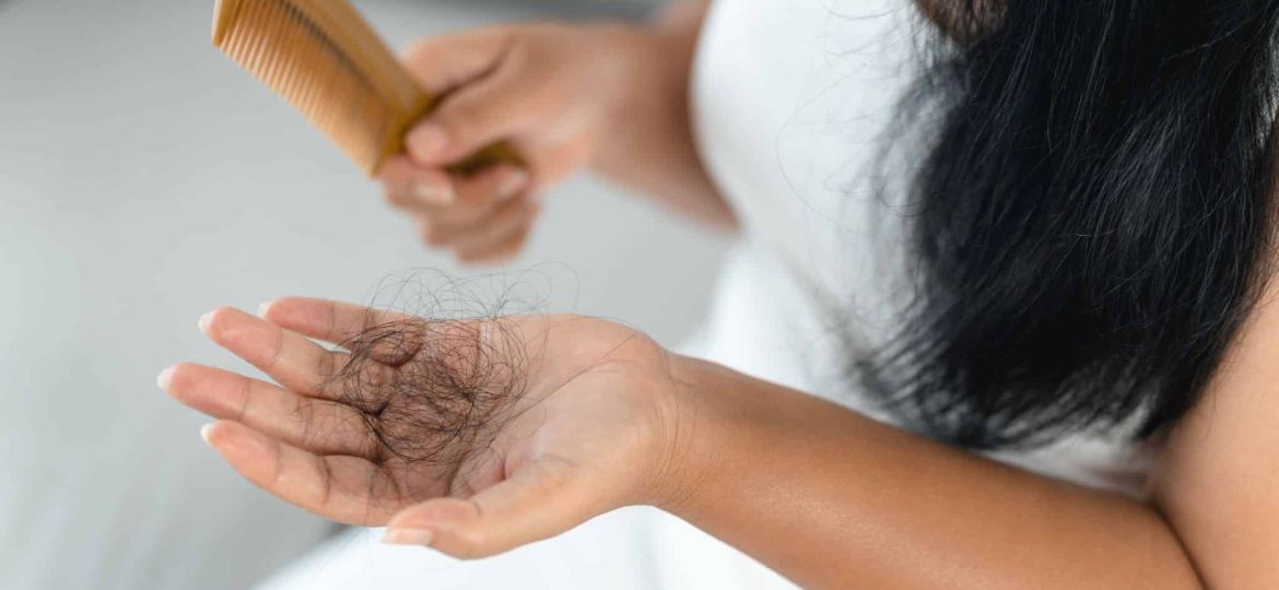What Hair Loss is Telling You About Your Hormone Levels