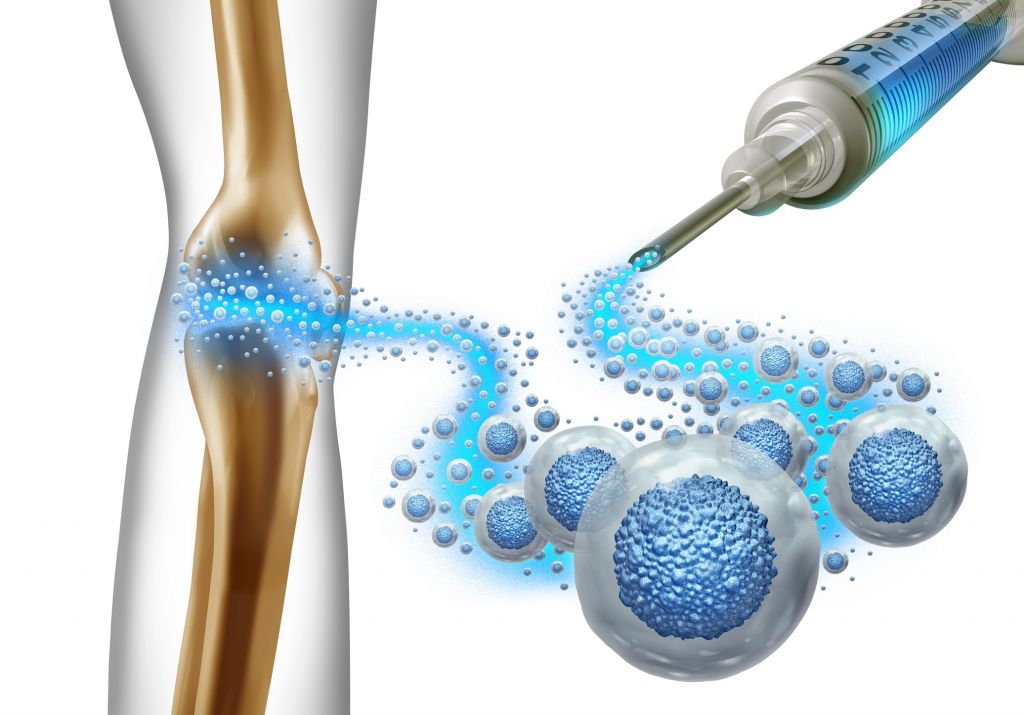 Breakthrough Uses of Stem Cells in Treating Orthopedic Conditions