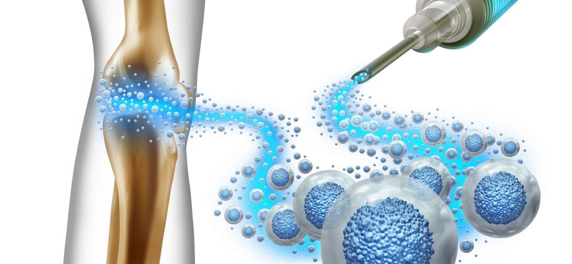 Breakthrough Uses of Stem Cells in Treating Orthopedic Conditions