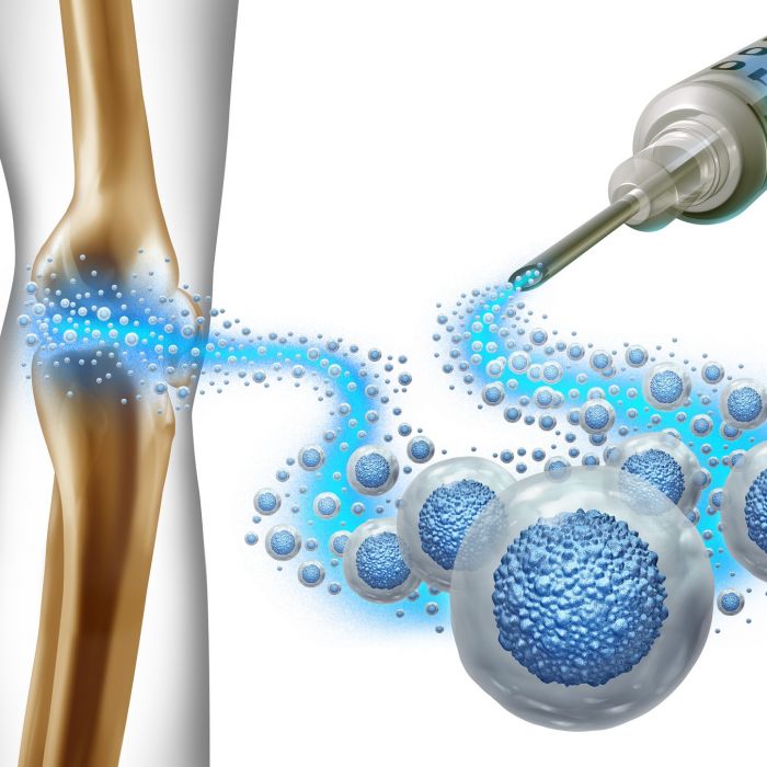 Breakthrough Uses of Stem Cells in Treating Orthopedic Conditions